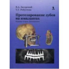 Протезирование зубов на имплантатах. 2-е изд., доп. Загорский В.А., Робустова Т.Г. - image 1